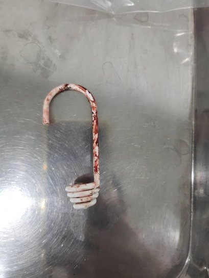 คุณหมอช่วยน้องคุกกี้ด้วยค่า !! ตะขอที่เกี่ยวอยู่ก็เด้งใส่ตา และปักห้อยอยู่